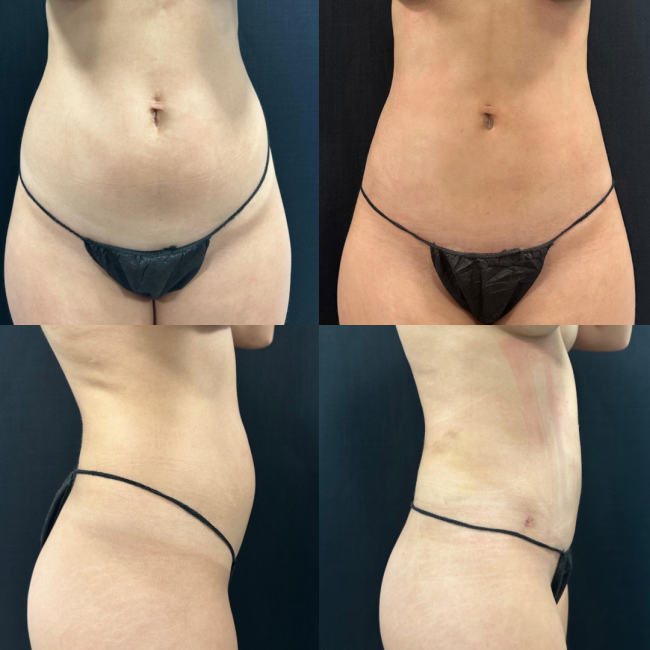 Cirurgio Vicente Sposito resultado final