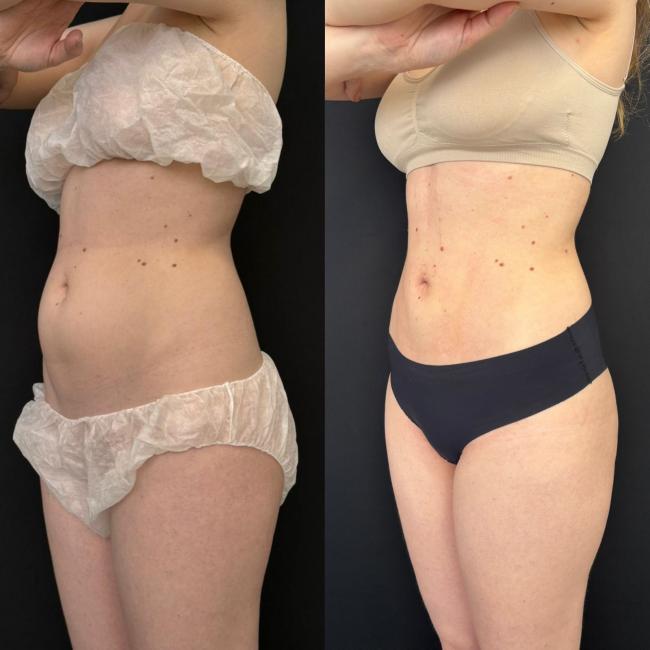 Cirurgia de Admmen - Vicente Sposito Cirurgio