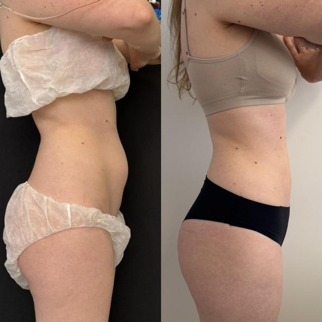 Procedimento pelas mos do Dr Vicente Sposito